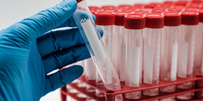 離心管的用途：購買離心管時應考慮的事項