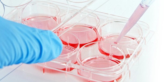 挑戰(zhàn)克服擴(kuò)大貼壁細(xì)胞