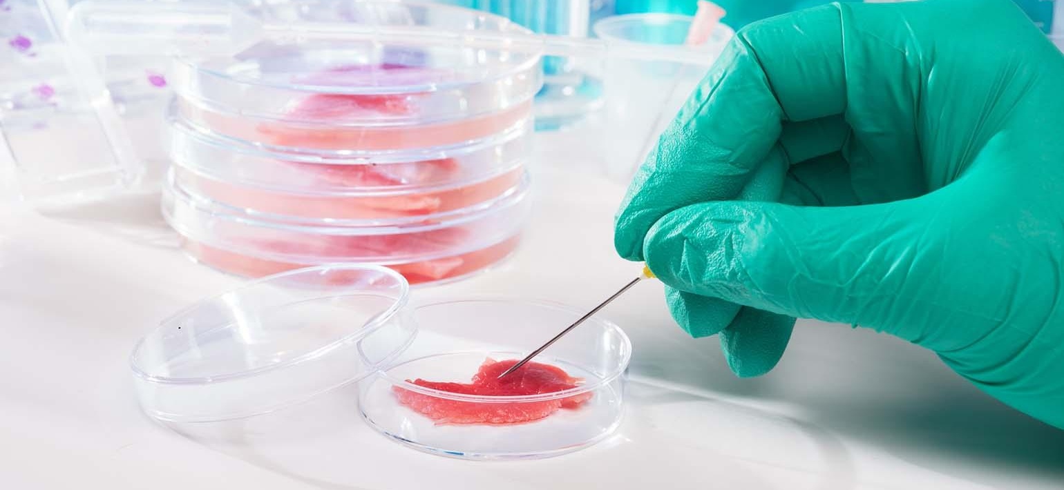 培養(yǎng)皿的規(guī)格尺寸