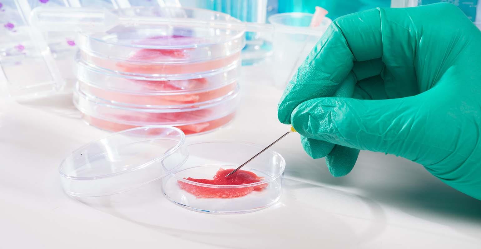 了解實驗室耗材：關于培養(yǎng)皿及其用途的一切